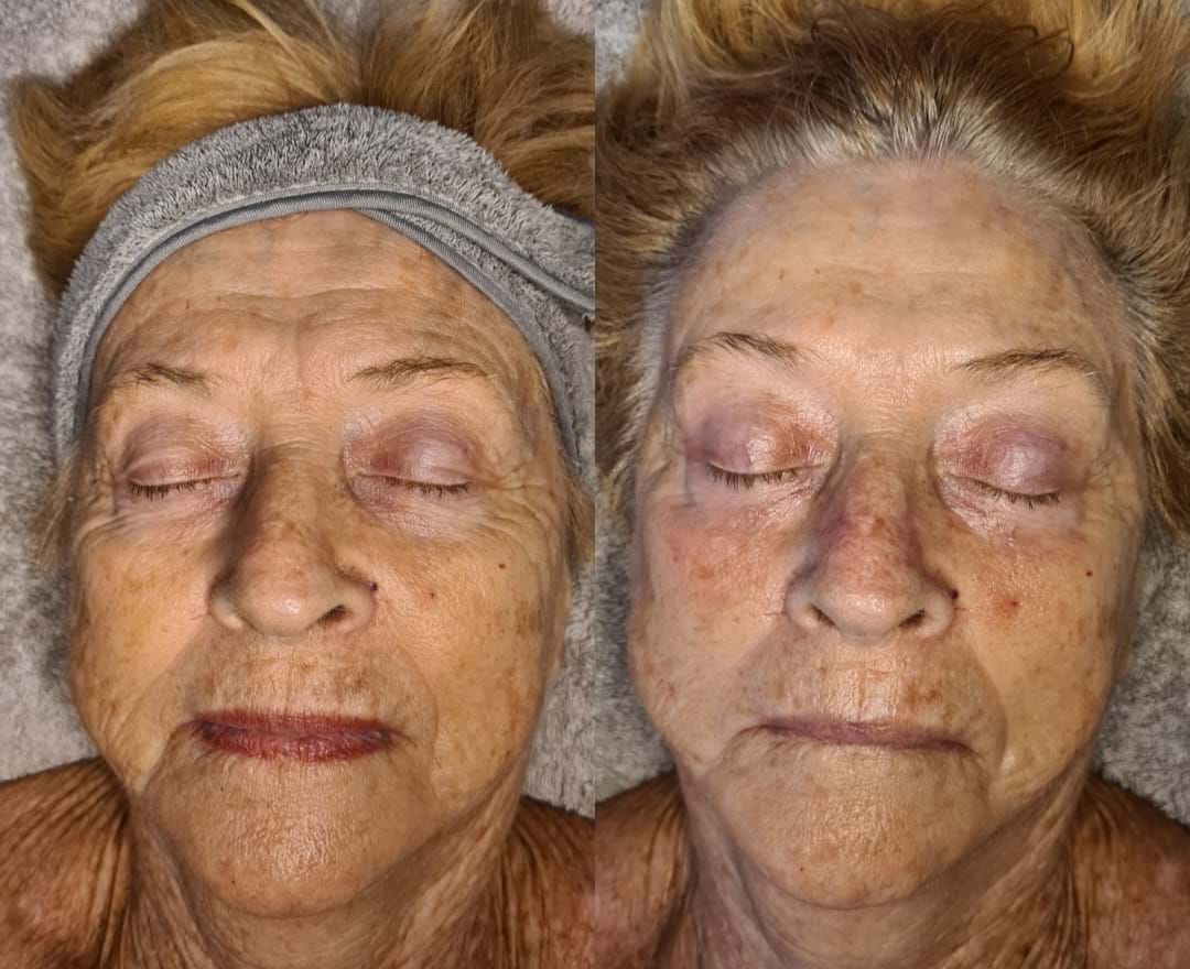 facial turramurra beauty salon/ beauty salon turramurra/ essentially you skin & beauty/ north shore beauty/ dry skin/ dehydrated skin/ wahroonga beauty salon/ turramurra beauty salon/ pymble beauty salon/ facials turramurra/ facials wahroonga